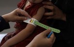 A measuring band for malnutrition around a child's arm. The band is on yellow, moving towards red.