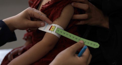 A measuring band for malnutrition around a child's arm. The band is on yellow, moving towards red.